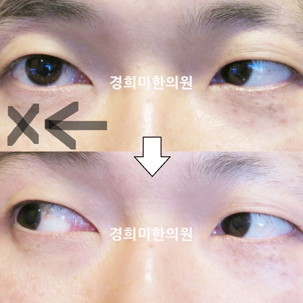 91번-16906-강강약-표시.jpg
