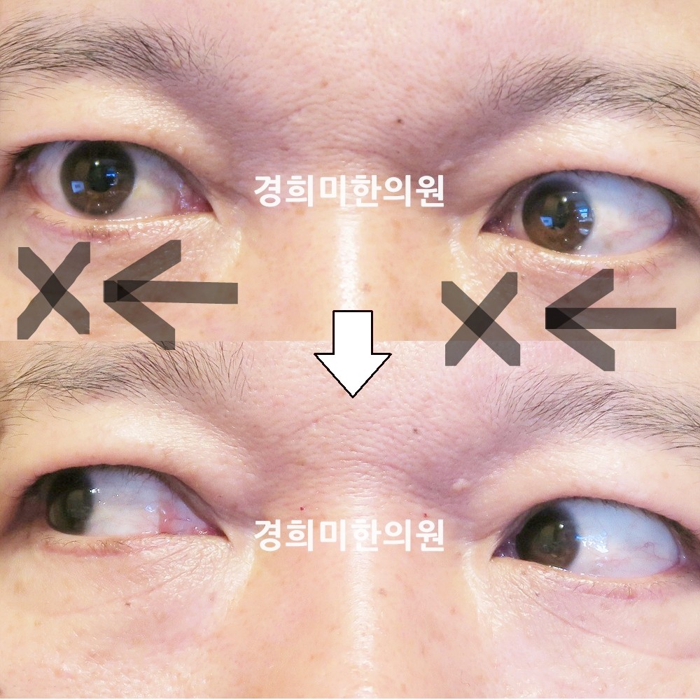 92번-16661-1-강강중-표시.jpg