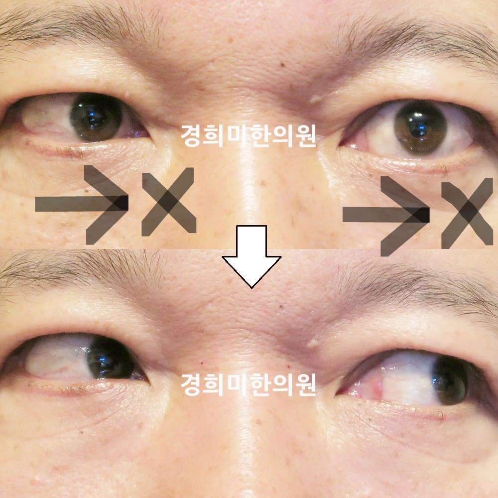 92번-16661-2-강강중-표시.jpg