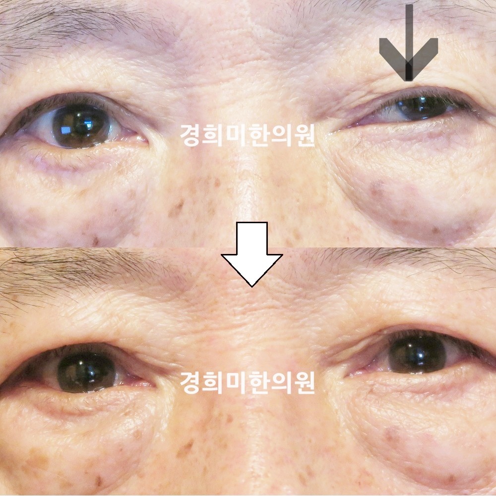 93번-17061-2-강강중-표시.jpg