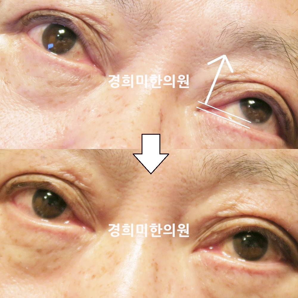 94번-17209-2-강강중.jpg