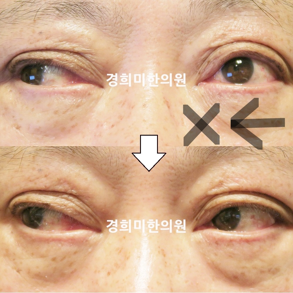 94번-17209-1-강강중-표시.jpg