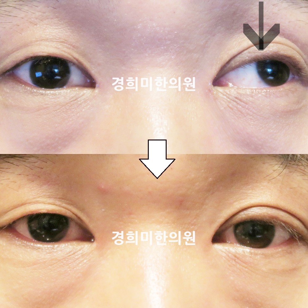 95번-17299-2-강강중-표시.jpg
