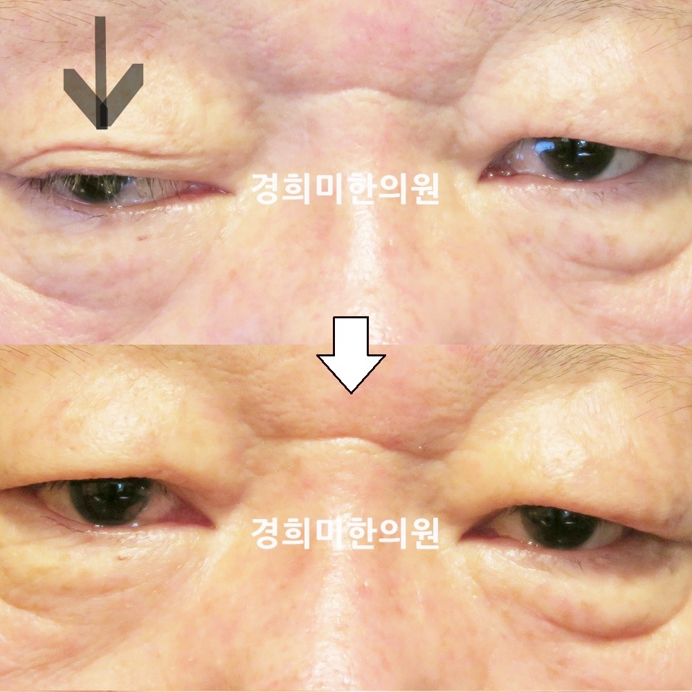 99번-17817-강강중-표시.jpg