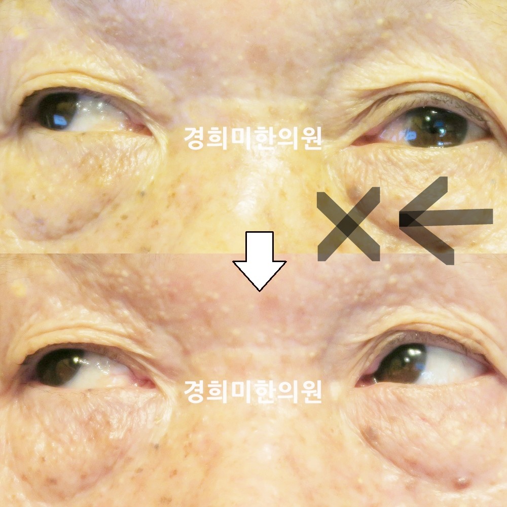100번-17777-1-강강중-표시.jpg