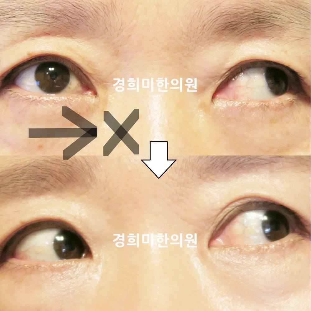 101번-17918-강강중-표시.jpg