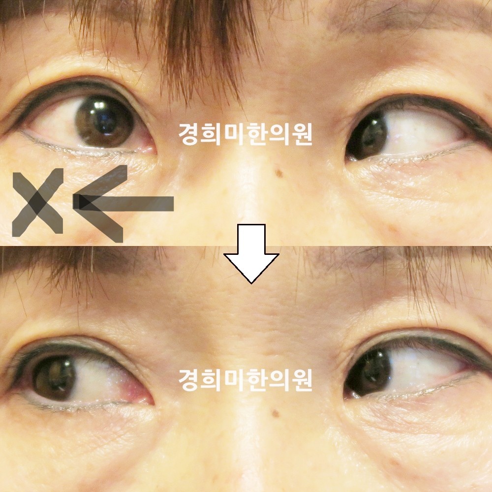 103번-17930-강강중-표시.jpg