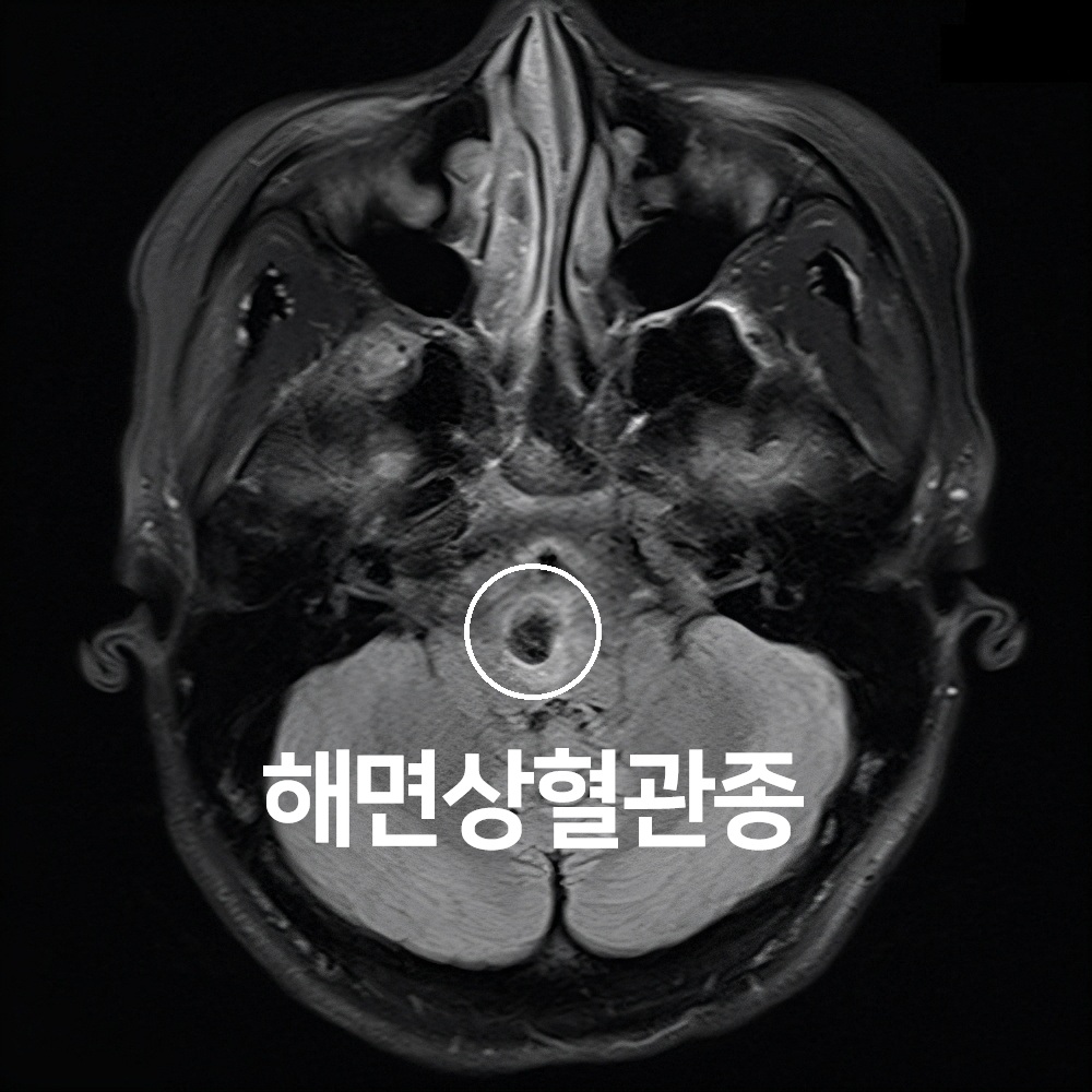 104번-17913 MRI3.jpg