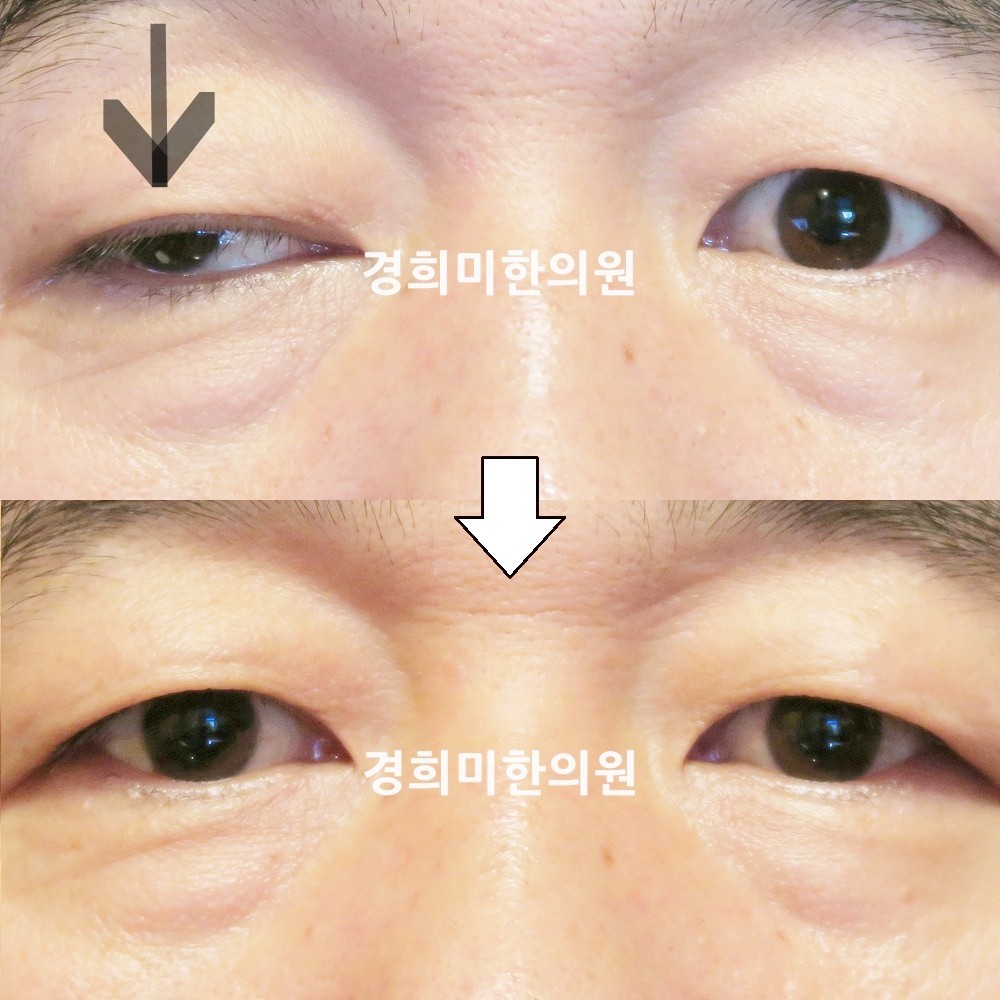 105번-17981-강강중-표시.jpg