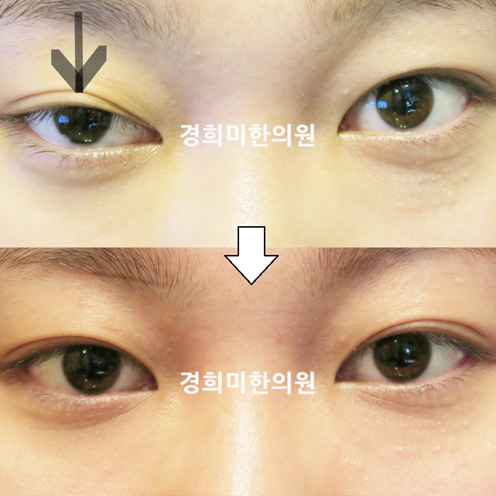 106번-18236-강강중-표시.jpg