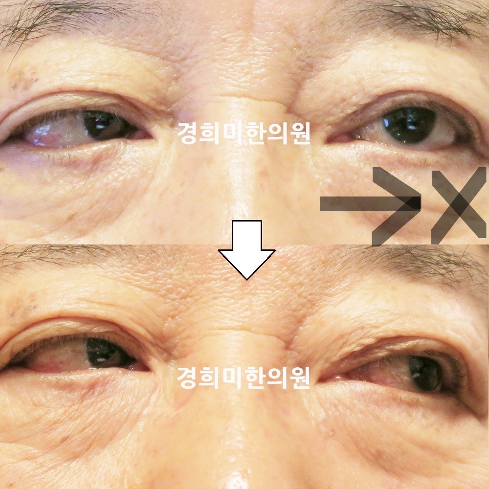 107번-18335-강강중-표시.jpg